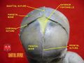 Sagittal suture.